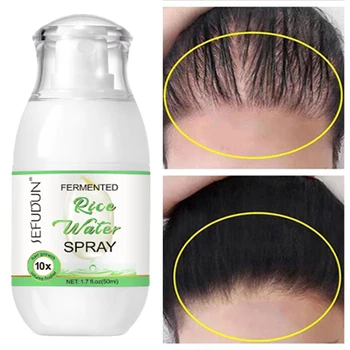 Ryžių Plaukų Augimo Produktai Išvengti Nuostolių Serumas, Alopecija, Seborėjinis Valsčiaus Aukštyn Galvos Odos Folikulo Gydymo Nuplikimas Grožis, Sveikata